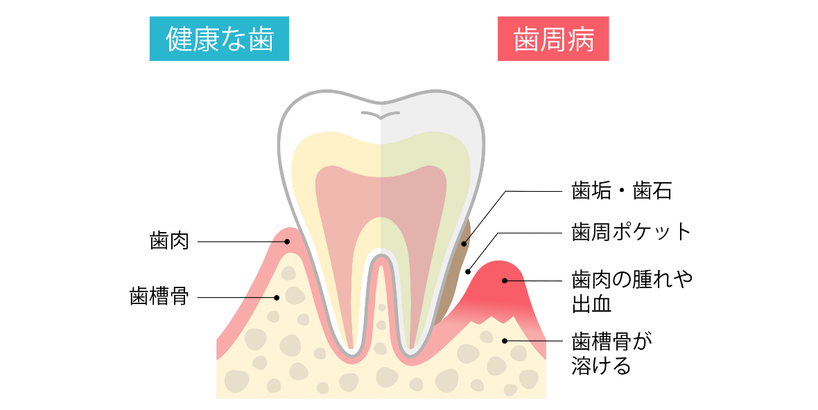原因